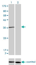 RAD1 Antibody (clone 1G2)