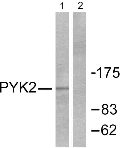 Polyclonal Rabbit anti-Human PTK2B / PYK2 Antibody (p580, IHC, WB)