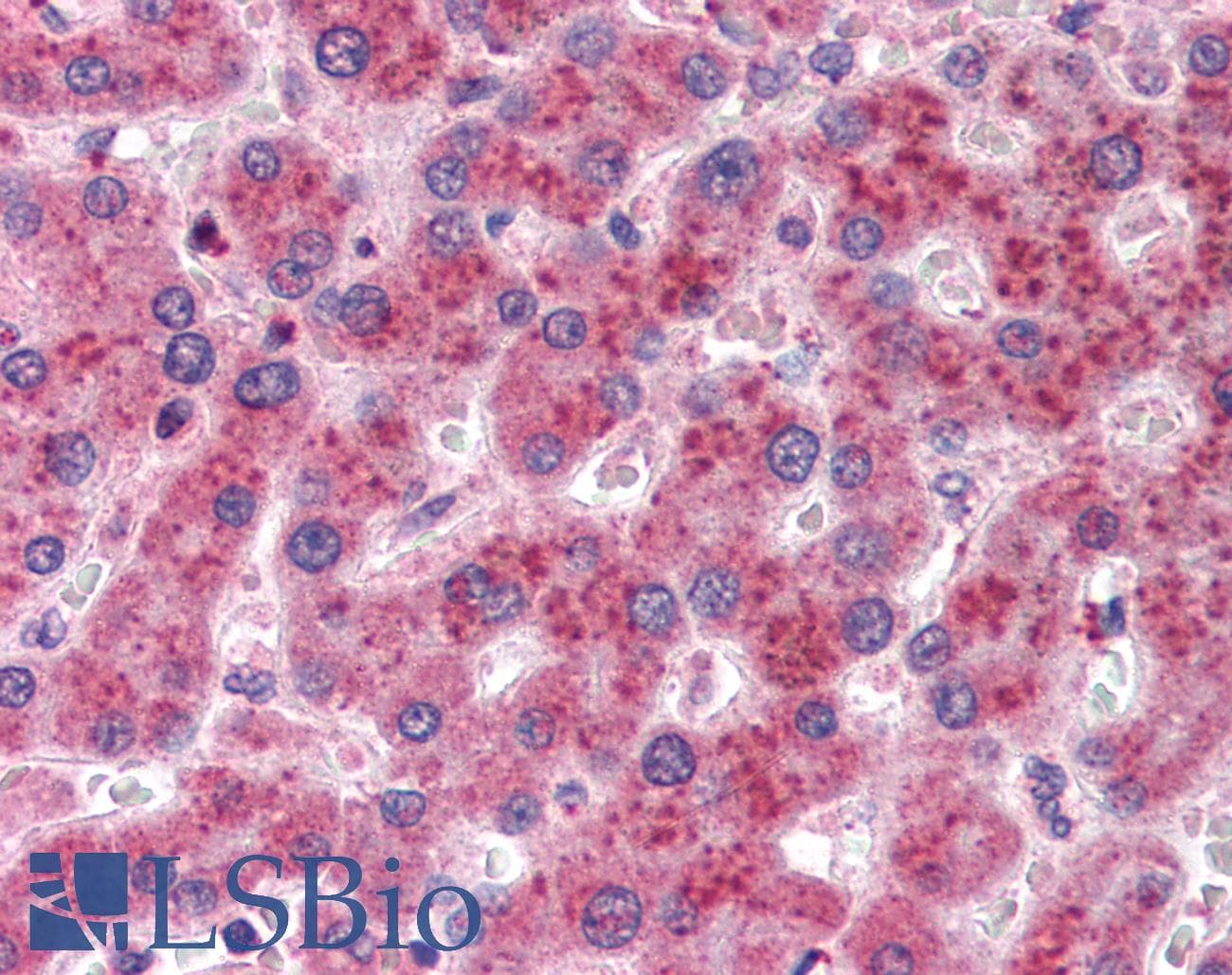 IHC-plus™ AKR1C4 / Chlordecone Reductase Antibody (aa2-14)