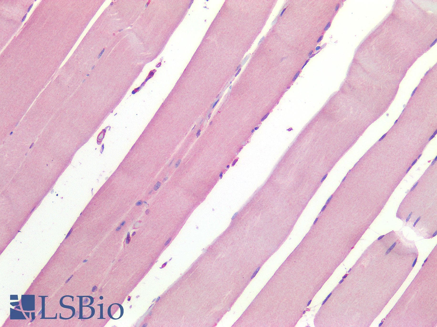 IHC-plus™ CX3CL1 / Fractalkine Antibody