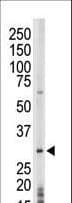 Polyclonal Rabbit anti-Human PRPK / TP53RK Antibody (aa220-249, IHC, WB)