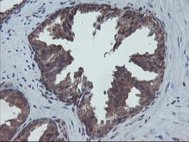 COMMD1 Antibody (clone OTI1F2)