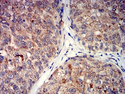 Monoclonal Mouse anti-Human GRM5 / MGLUR5 Antibody (clone 1A11D10, IHC, WB)