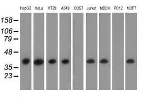 HIBCH Antibody (clone OTI3H5)
