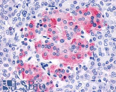 PathPlus™ FZD8 / Frizzled 8 Antibody (N-Terminus)