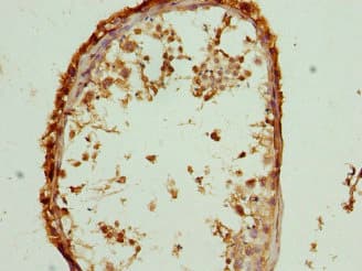Polyclonal Rabbit anti-Human M6PR Antibody (WB)