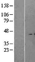 A4GALT Protein (Over-Expression Lysate Myc-DDK (Flag))