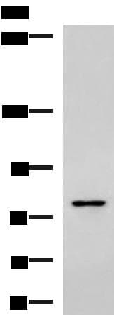 Polyclonal Rabbit anti-Human SKI Antibody (IHC, WB)