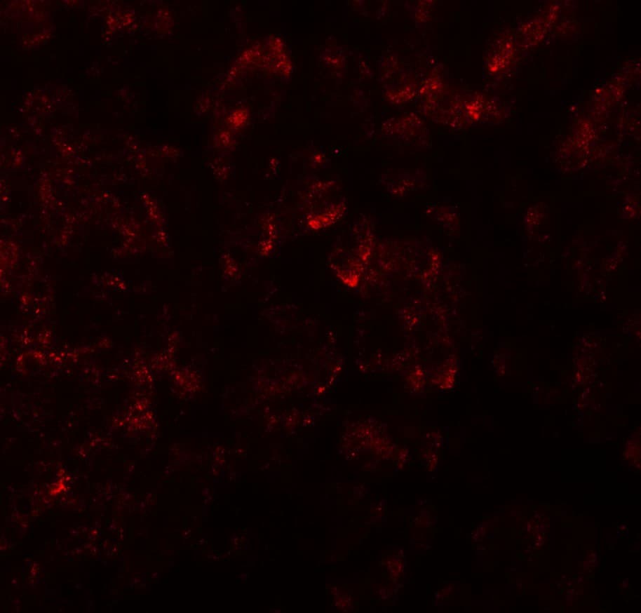 KIRREL2 / FILTRIN Antibody