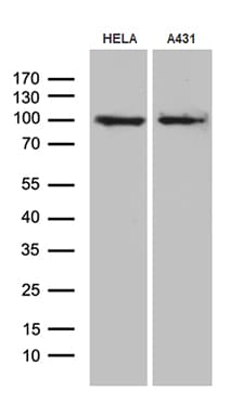 MLH1 Antibody (aa1-298, clone OTI2A8)