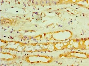 GOPC / PIST Antibody (aa203-462)