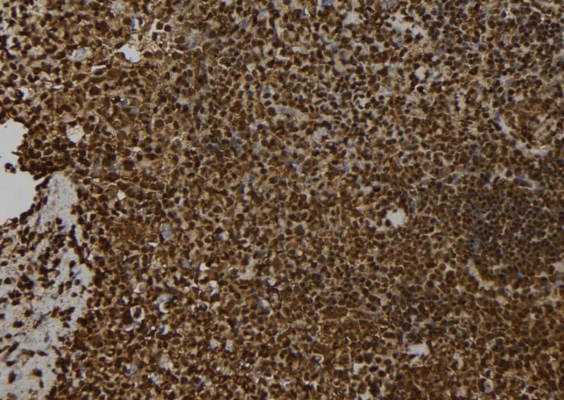 SNCAIP / Synphilin 1 Antibody