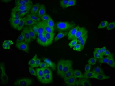 DLG2 / PSD93 Antibody