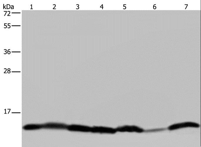Polyclonal Rabbit anti-Human HIST1H2AH Antibody (IHC, WB)