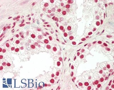 IHC-plus™ SP1 Antibody (aa735-785)