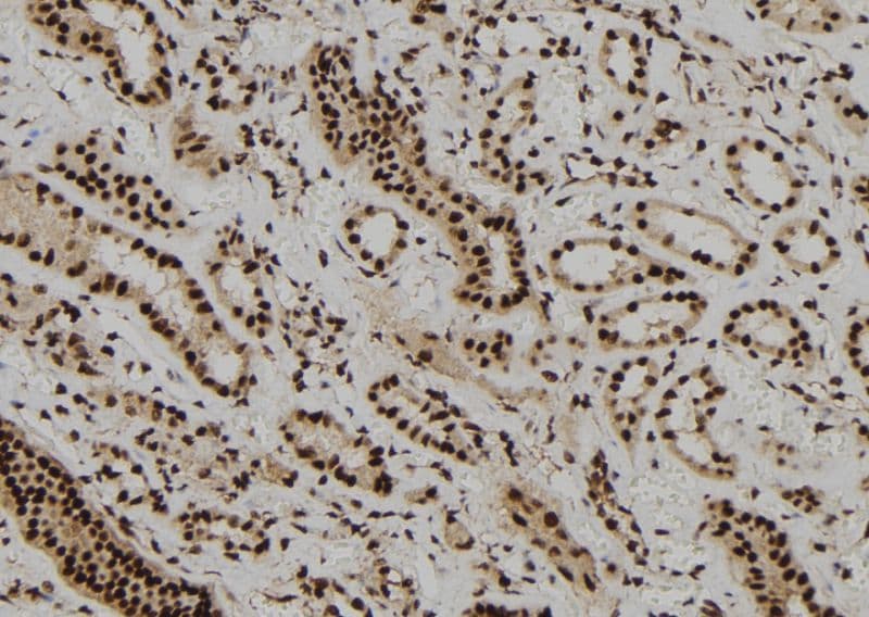 DBR1 Antibody