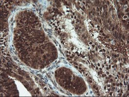 UBE2E3 Antibody (clone OTI7E8)