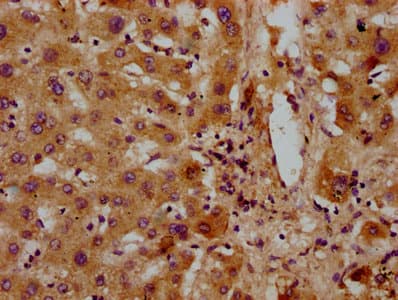 GATB / PET112 Antibody