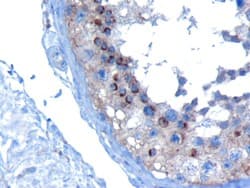 VPS28 Antibody (aa209-221)