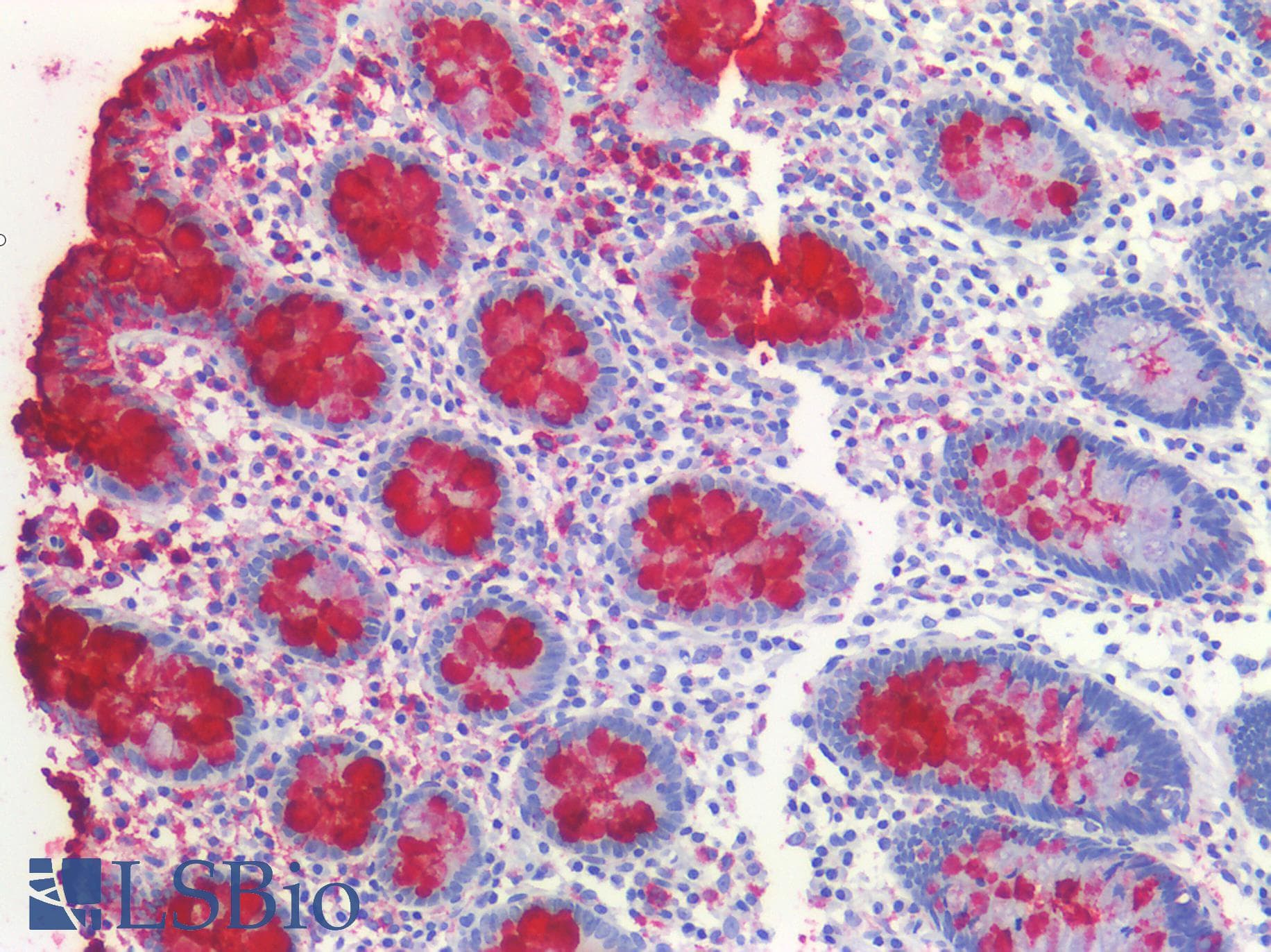 PathPlus™ Monoclonal Mouse anti-Human Sialylated Lewis a / CA 19-9 Antibody (IHC)