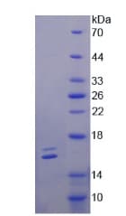 Human Osteoglycin / Mimecan Protein (Recombinant His)