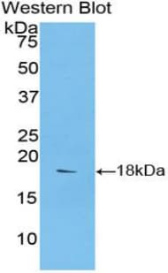 SEMA3A / Semaphorin 3A Antibody (aa31-150)