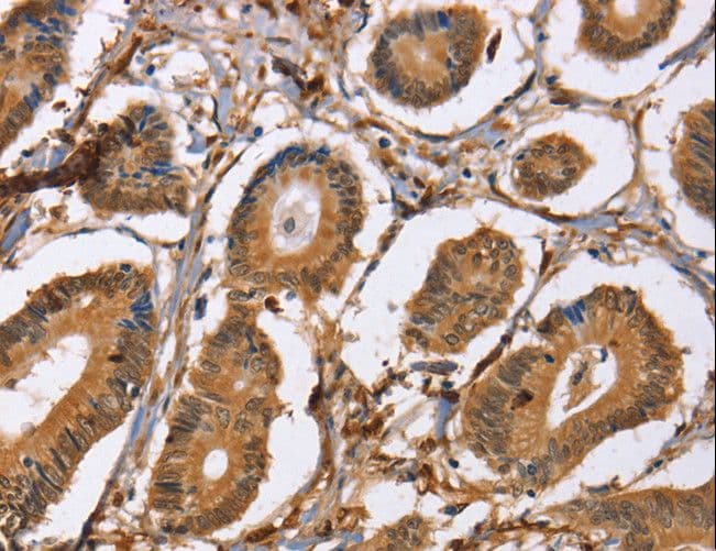 Latexin / MUM Antibody