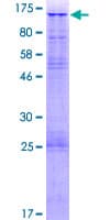 Human URG4 / URGCP Protein (Recombinant GST)