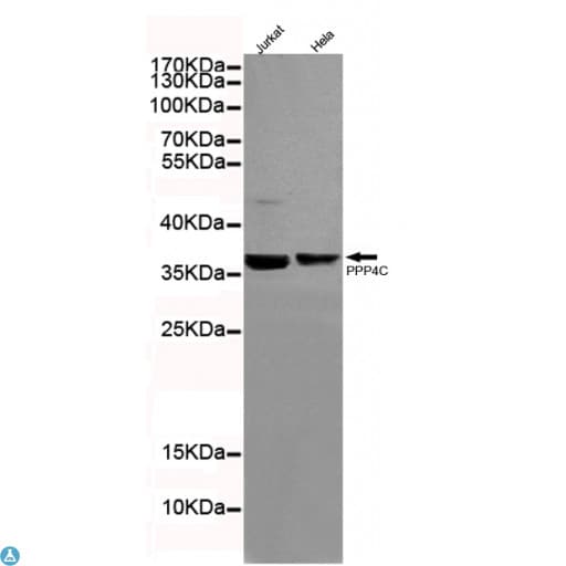 Monoclonal Mouse anti-Human PPP4C Antibody (WB)
