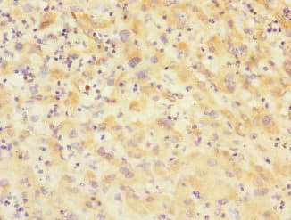 VARS / ValRS Antibody