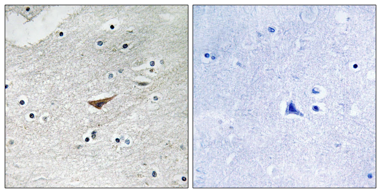 Polyclonal Rabbit anti-Human CD144 / CDH5 / VE Cadherin Antibody (phospho-Tyr731, IHC, WB)