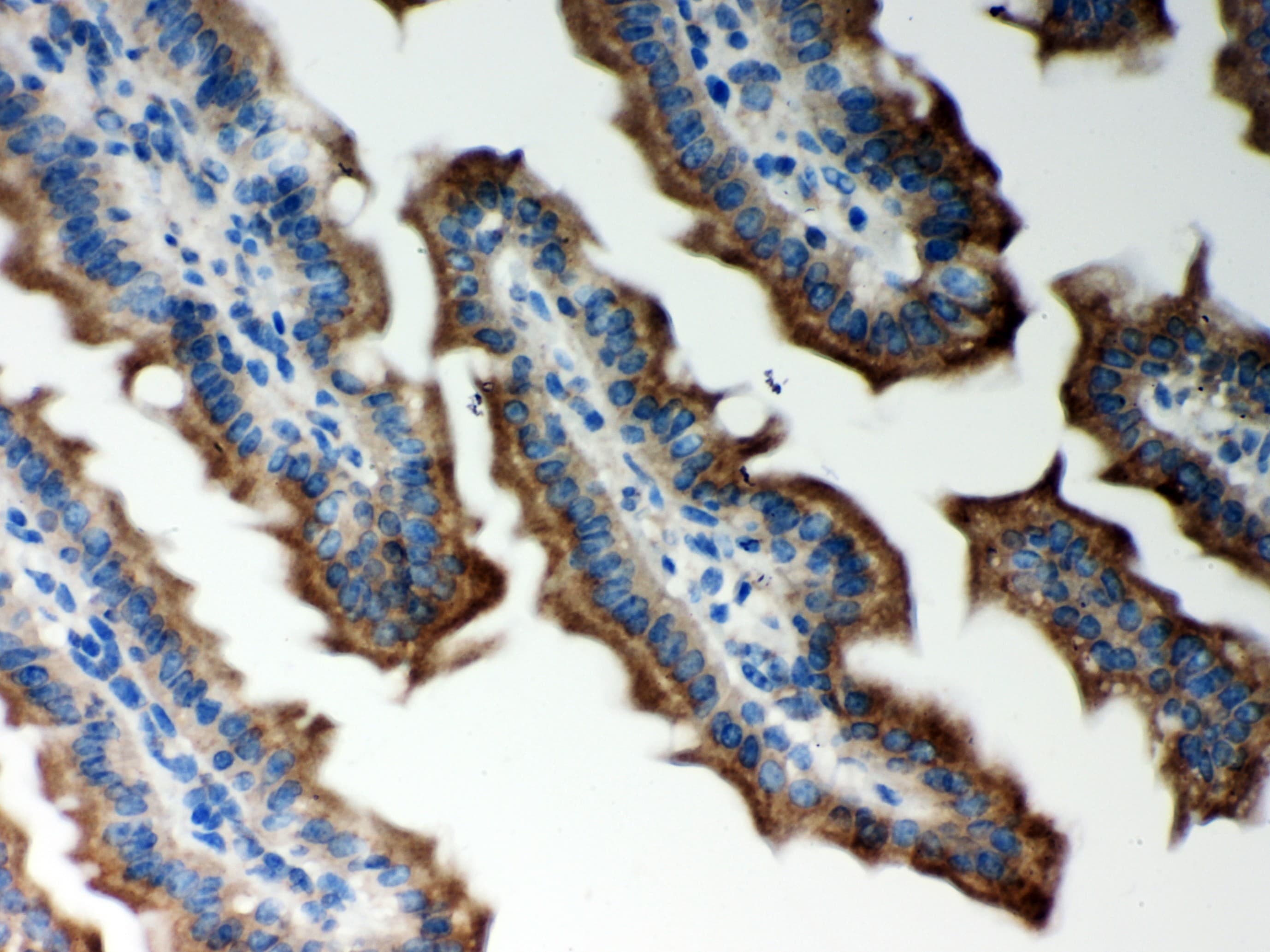 PRDX5 / Peroxiredoxin 5 Antibody (aa66-198)