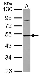Polyclonal Rabbit anti-Human ATXN3 / JOS Antibody (aa1-245, IHC, WB)