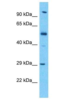 KLK13 / Kallikrein 13 Antibody (aa87-136)