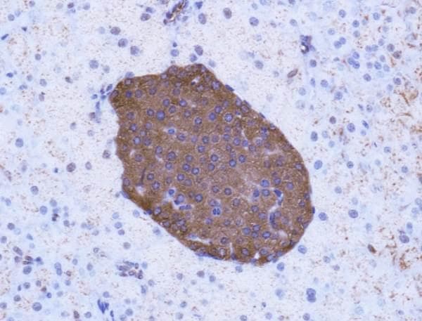 GLP1R / GLP-1 Receptor Antibody (Biotin)