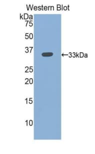 Polyclonal Rabbit anti-Human ITGB3 / Integrin Beta 3 / CD61 Antibody (FITC, aa135-377, WB)