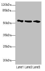 Polyclonal Rabbit anti-Human EIF2S3 / EIF2G Antibody (IHC, WB)