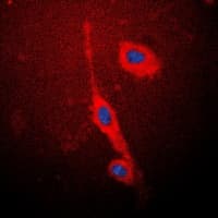 Polyclonal Rabbit anti-Human NOS3 / eNOS Antibody (C-Terminus, IHC, IF, WB)
