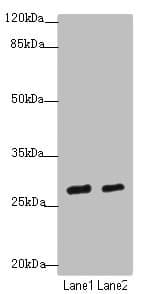 BTEB / KLF9 Antibody
