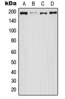 Polyclonal Rabbit anti-Human EGFR Antibody (phospho-Ser1071, WB)