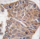 Polyclonal Rabbit anti-Human AKT2 Antibody (aa416-444, IHC, IF, WB)