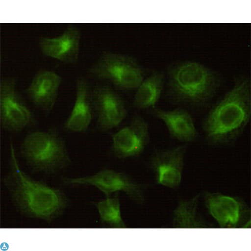 Monoclonal Mouse anti-Human CBR / CBR1 Antibody (WB)