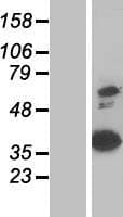 ANXA8 / Annexin A8 Protein (Over-Expression Lysate Myc-DDK (Flag))