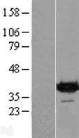 DENND1B Protein (Over-Expression Lysate Myc-DDK (Flag))