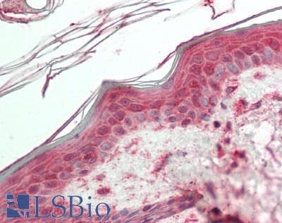 VPS52 / SACM2L Antibody (aa467-516)