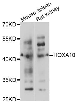 Polyclonal Rabbit anti-Human HOXA10 Antibody (WB)
