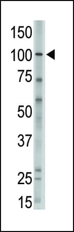 MVP / VAULT1 Antibody (aa863-893)
