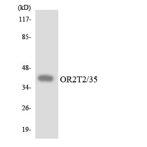 OR2T2 + OR2T35 Antibody (aa46-95)
