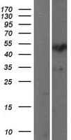 SP7 / Osterix Protein (Over-Expression Lysate Myc-DDK (Flag))