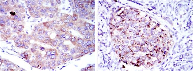 EEF2 / Elongation Factor 2 Antibody (clone 5B6)